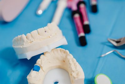 Top 5 Benefits of Regular Dental Check-Ups
